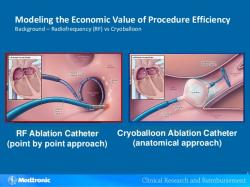 Porovnanie rádiofrekvenčnej ablácie a kryoablácie: Pri klasickej rádiofrekvenčnej ablácii (vľavo) sa ústie pľúcnej žily izoluje postupnými bodovými léziami, pri balónovej kryoablácii (vpravo) vznikne naraz kruh zmrazeného tkaniva ako odtlačok priloženého balóna. (Kredit: Výrobca kryobalónov Medtronic).