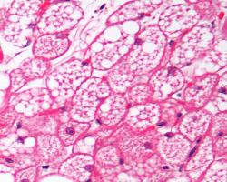 Podél velkých cév se v hojné míře nachází takzvaná hnědá tuková tkáň tvořená multivakuolárními adipocyty. Hnědé adipocyty obsahují četné mitochondrie, kde dochází k odpojení transportního řetězce elektronů a vytváření tepla. Vzhled tomuto typu tukové tkáně dávají cytochromy. Scientific Foundation, Blood Vessels Lab. YALE.