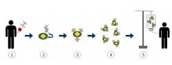 Schémia postupu pri liečbe CAR T-bunkami ( 1. odber krvi a separácia T-lymfocytov. 2. zavedenie génu pre chimérický receptor vírusovým vektorom. 3. vytvorenie receptorov v bunkovej membráne. 4. pomnoženie modifikovaných lymfocytov. 5. podanie lieku pacientovi) Kredit: Reyasingh56, Wikimedia Commons, CC BY-SA.0
