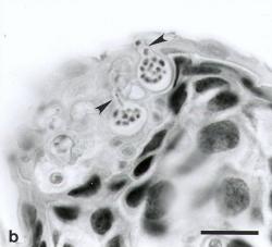 Řez kůží nakažené žáby. Mikroskop odhalí baňkovité sporangie a přepážkovité stélky uvnitř pokožky. Dozrálé zoospóry se z hostitelské buňky derou ven jakýmisi choboty a jsou připraveny napadnout další oběť. Pro představu titěrnosti parazita je dole měřítko odpovídající délce 35 µm.