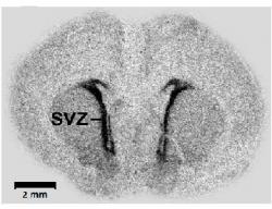 Radiografický snímek tenkého řezu mozku potkaního embrya s označením subventrikulární zóny (SVZ) Kredit: Wikipedia, Popp et al., 2009, CC BY 2.5.