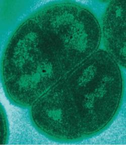 Bakterii Deinococcus radiodurans nezlomí ani vakuum vesmíru. Ve stavu spory přežije i dávku záření gama desetitisíckrát vyšší, než smrtelná pro člověka. Zdroj obrázku:Michael Dalylab. Volné dílo.