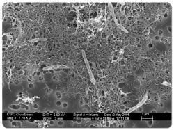 Mikrob nazvaný Candidatus Desulforudis audaxviator je monospecifickým rodem bakterií. Na délku má okolo čtyř mikrometrů a daří se mu v hloubkách 1,5–3 kilometrů pod zemským povrchem. Jeho život je navázán na radioaktivní rozpad minerálů v okolní hornině.  Kredit: Wikipedia, volné dílo.