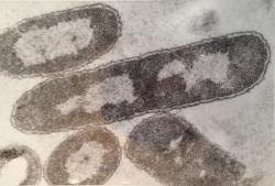 Prvním stabilním polosyntetickým organismem je Escherichia coli. Na snímku je zvětšena 78 000x. (Kredit: Peter Highton )
