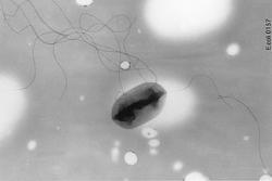 Escherichia coli . Kredit: Center for Disease Control