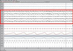 Záznam elektrického potenciálu v době spánku (EEG) svědčí o vysoké  mozkové aktivitě. Při přednáškách v posluchárně rád  lenoší - viz zde.  https://richmerlo.blogspot.com/2013/10/