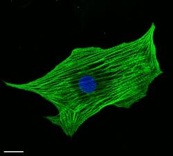Embryonální kmenová buňka srdeční tkáně (označena modře). Kredit: Gepstein Laboratory.