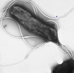 Helicobacter pylori (název složen ze slov: „helix“– šroubovice, „bacter“– bakterie, „pylorus“– vrátník) je druh mikroaerofilní gramnegativní patogenní bakterie, jež napadá sliznici žaludku. Odhaduje se, že je ve vyspělých zemích touto bakterií infikována více než polovina dospělých po 60 letech věku, ačkoliv nemusí vždy vyvolat onemocnění. Kredit: Yutaka Tsutsumi, Fujita Health University School of Medicine, Wikipedia.