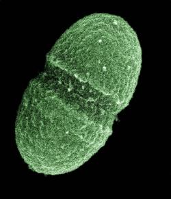 Jeden ze zástupců enterokoků (Enterococcus faecalis), Gram-pozitivní, komensální bakterie gastrointestinálního traktu.  (Credit: CC0 Public Domain).