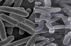 Živé Escherichie coli (vlevo) spolu s laktobacily byly hlavními hráči v podávaném probiotiku. Prospěly k rozvoji dalších střevních bakterií.