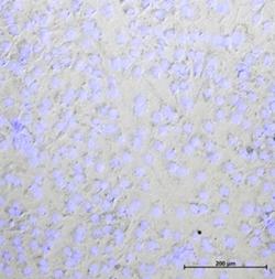 Na obrázku jsou rozptýlené buňky, které mají vřetenovitý tvar. To je pro kulturu fibroblastů charakteristické. Modře je barvičkou zviditelněná DNA, což poskytuje informaci o počtu buněk. Kultura vypadá zdravě a její buňky jsou zcela odlišné od buněk, které byly vystaveny kontaktu s prachem a jejichž obrázek je uveden níže. Kredit: Christopher Kassotis