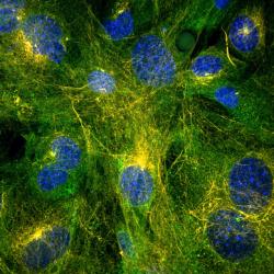 Cytoskelet kožních fibroblastů. Takto členitá buňka to má s vířením o poznání složitější než dokonale kulaté vajíčko, ale nepochybujme, že víří. Jádra jsou obarvena modře, mikrotubuly oranžově (acetylovaný α-tubulin) a zeleně (γ-tubulin). Kredit: Jan Tůma (Lékařská fakulta v Plzni).