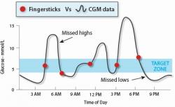 Jednorazové merania nemusia zachytiť všetky výkyvy hladiny glukózy