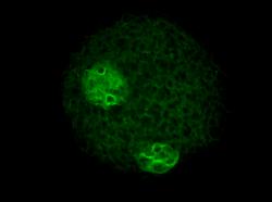 Zeleně značený sirtuin v jednobuněčné zygotě, exkluzivně se vyskytující poblíž chromatinu. Pravděpodobně tam zrovna moduluje histonový kód…
