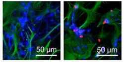 Obrázky ukazují jak neurony uvedené do stresu dopadnou. Vlevo vědci astrocytům jejich ochotu pomáhat ztížili.  Neurony s lenivými astrocyty v kontaktu po 48 hodinách hynou. Na pravém obrázku astrocyty své neurony v jejich špatném čase na holičkách nenechaly. Podpořily je dodáním funkčních mitochondrií. Imunoenzymatické barvení buněk dokazuje že k převodu mitochondrií skutečně došlo a že se po něm neuronům daří vcelku dobře. (Kredit: Hayakawa et al.  Massachusetts General Hospital, 2016)