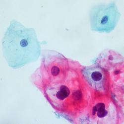 V mikroskopu jsou genitální bradavice vcelku přijatelné. Kredit: Ed Uthman / Wikimedia Commons