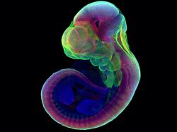 Myší embryo rostlo 6 dní mimo dělohu. Kredit: HANNA, ET. AL./WEIZMANN INSTITUTE OF SCIENCE / NATURE.