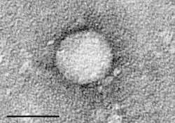 Tak to je on, virus hepatitidy C (Kredit: Maria Teresa Catanese, Martina Kopp, Kunihiro Uryu, a Charles Rice, Wikipedia)