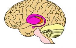 Huntigtonova choroba je dědičné neurodegenerativní onemocnění charakteristické nekoordinovanými trhavými pohyby těla a sníženými mentálními schopnostmi. Dědí se autozomálně dominantně, což znamená, že k projevu nemoci stačí zdědit jednu alelu. Nejprve postihuje bazální ganglia a přidružené oblasti mozku - purpurově. (Kredit: FDA)