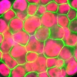 Indukované pluripotentní kmenové buňky. Kredit: UCLA Broad Stem Cell Research Center/Plath Lab.