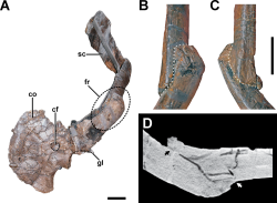 Jedna z mnoha paleopatologií zjištěná na fosiliích pozdně jurského severoamerického a evropského teropoda rodu Allosaurus – frakturovaná lopatka. U stejného jedince z morrisonského souvrství ve Wyomingu bylo objeveno také množství dalších poranění, zejména na žebrech, dále také na krčních obratlích nebo dolní čelisti. Kredit: Foth, C.; et al.; Wikipedia (CC BY 4.0)