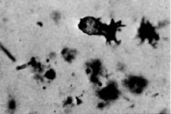 Jedna z prvních fotografií mikrofosilií od Hořejšího jezera pochází z padesátých let. (Geology dept. Archive University of Wisconsin-Madison)