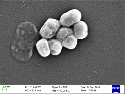 Acinetobacter baumannii patří do skupiny patogenů s vysokou mírou antibiotická rezistence, která je zodpovědná za většinu nozokomiálních infekcí. Obrázek je pořízen skenovacím elektronovým mikroskopem. Kredit Vader1941, CC BY-SA 4.0.