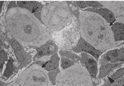 Lidské indukované kmenové buňky (označeny černými šipkami) v umělém vaječníku v němž myší buňky těm lidským hrají roli školitelek k jejich přeměně na buňky pohlavní (vajíčka). Školitelky jsou ty tmavší, jedna je označena trojúhelníčkem. Kredit: Chika Yamashiro, Kyoto University.