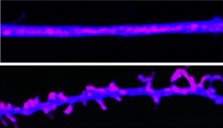 Paměťové stopy jsou ukládány pomocí prionovým proteinům podobným molekulám. Vědci je nazvali CPEB. V mozku udržují synapse (spodní část obrazu).  Když CPEB priony inaktivujeme, synapse se hroutí a paměť slábne (viz stejný neuron v horní část obrázku). Kredit: Lab. David Sulzer, CUMC