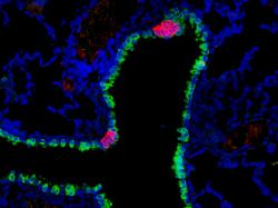 Plicních neuroendokrinních buněk (červené) je v moři epitelových buněk (zelené) poskrovnu. Jejich vliv na imunitní systém už tak skromný není. Na to, jak málo jich je, se do zdraví a nemoci pletou až moc. Kredit: Leah Nantie, Univ. Wisconsin - Madison