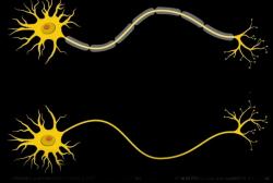 Neurony mají na svém povrchu ochranný obal nazývaný myelin (šedě). Izoluje axon a umožňuje  elektrickou komunikaci mezi neurony. Nemocní Williamsovým syndromem mají vrstvu myelinu  tenkou, vzruch se šíří pomalu. Kredit: Opus Design.