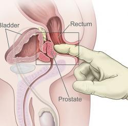 Čtyřprocentní menšina má prostatu především na dráždění, které si provádí masáží hrázky, nebo přímo, přes stěnu konečníku k uspokojení  pasivního partnera homosexuálního pohlavního styku. Nám ostatním je k tvorbě asi 30 % ejakulátu a typického zapáchu spermatu. Obohacuje jej o imunoglobuliny, enzymy – proteázu a fosfatázu, prostaglandiny, kyselinu citronovou, zinek, a další složky, z nichž každá nějak spermiím zvyšuje oplodňující šance.  Kredit:  National Cancer Institute