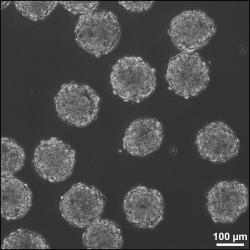 Embryoidy tvořené zhruba tisíci kmenovými buňkami. Kredit: Stemcellscientist, Wikipedia, CC BY-SA 3.0