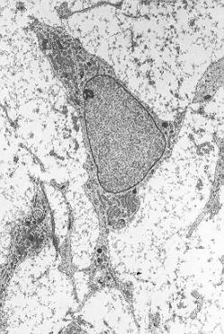 Mezenchymální kmenová buňka. Tyto buňky jsou ochotnými dárci mitochondrií a jejich prostřednictvím lze buňkám v nesnázích předat mitochondrie a vylepšit jim tím jejich výkonnost i vyhlídky na přežití. Obrázek buňky je z elektronového mikroskopu. Kredit: Robert M. Hunt. CC BY 3.0.