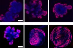 Zkratka Ki67 se používá jako charakteristický znak buněčného množení (proliferace). Související antigen Ki-67 je protein plnící funkce v jádře buněk. Vizualizovat se dá pomocí reakce s monoklonální protilátkou pro Ki Protein. Ten je exprimován ve všech množících se buňkách. Zde  je imunohistochemické barvení použito k vizualizaci  počtu dělících se buněk v organoidech. Spodní řada obrázků představuje tří pasáže při nichž bylo aplikováno stlačování buněk (horní obrázky jsou kontroly). Je na nich patrné rychlejší množení buněk s robustním růstem organoidů. (Kredit:  MIT News) https://meche.mit.edu/news-media/make-mini-organs-grow-faster-give-them-squeeze