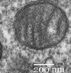 Mitochondrie (Kredit: Wikipedia)