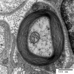 Za nového viníka skryté ztráty sluchu je označena ztráta myelinu na axonech neuronů. Na obrázku myelinová pochva připomínající hebkou šálu ochraňující cytoplasmmu a její orgány uvnitř nervového výběžku. (Kredit: Electron Microscopy Facility, Trinity College, Hartford, CT CC BY-SA 3.0)  https://cs.wikipedia.org/wiki/Myelin#/media/File:Myelinated_neuron.jpg