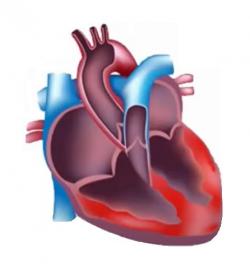 Myokarditida, známá také jako zánětlivá kardiomyopatie, je zánět srdečního svalu. Kredit: Medical Centric.