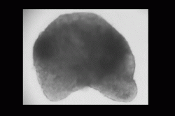 Organoid - „srdce“ vyrobené kultivací z myších kmenových buněk. Dobře patrné jsou na něm počínající rytmické stahy.  Kredit: University of Virginia.
