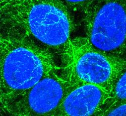 Když buňkám chybí kritický signální enzym (jaterní buňky na preparátu jsou obarveny modře), uchylují se ke komunikaci a sdílení zdrojů prostřednictvím vezikul (zeleně). Tato strategie dovoluje buňkám se množit i v prostředí, které to jiným buňkám nedovoluje. Stejnou taktiku mohou využívat i rakovinové buňky. Kredit: UC San Diego Health Sciences
