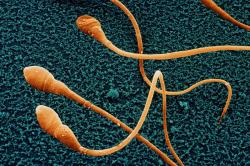 Na věku záleží. Kredit: Juergen Berger/SPL