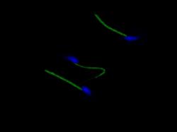 Persulfidace (chcete-li sulfhydratace) v myších spermiích. Jak je vidět, persulfidace zasahuje především proteiny, nacházející se v blízkosti mitochondrií. Mitochondrie vyrábějí pro spermii nezbytnou energii, ale současně jsou největšími producenty volných radikálů. Modrá – DNA, zelená – persulfidace. Kredit: HŘ.