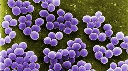 Bakterie Staphylococcus aureus uchycené na ortopedickém implantátu. Kredit: US Centers for Disease Control and Prevention.
