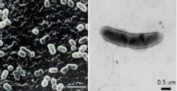 Prevotella gramnegativní anaerobní fermentující tyčky (vlevo) se od  Oscillibacteru vzhledově prakticky neliší. Obě bakterie produkují metabolity tlumící ve stěně střeva množení buněk Th17. K Kredit:（NITE NBRC) 電子顕微鏡写真 飯野