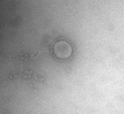 Virus pohledem elektronové mikroskopie. Zdroj: ZU Ostrava, virologická laboratoř.
