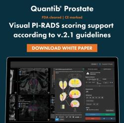 Nástroj AI na hodnotenie MRI nálezov na prostate. (Kredit: Quantib). Nástroj AI na hodnotenie MRI nálezov na prostate. (Kredit: Quantib).