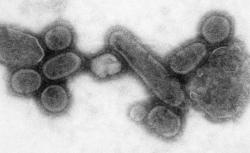 Ačkoliv původce pocházel z Asie, paradoxně se mu přezdívalo „španělská chřipka“. Šlo o virus A H1N1. Typem tedy stejný virus u něhož kultivace na vejcích se může zavinit problém neúčinnosti. Je proto obávanou hrozbou dodnes. Kredit: CDC.