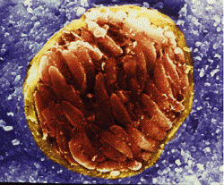 Toxoplasma gondii, bradyzoit - cysta ve tkáni mezihostitele. (Kredit: Vikipedia)