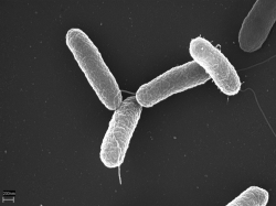 Salmonely. Ale které? Břišního tyfu? Paratyfu? NTS salmonely? Nebo snad ty rezistentní na antibiotika? (Kredit: Volker Brinkmann, Max Planck Institute for Infection Biology.)