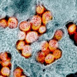 Transmisní elektronová mikrofotografie virových částic způsobujících nemoc COVID 19.  Kredit: National Institute of Allergy and Infectious Diseases, NIH